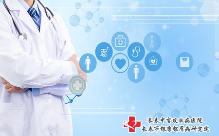 延边哪里看牛皮癣,去延边哪里看牛皮癣