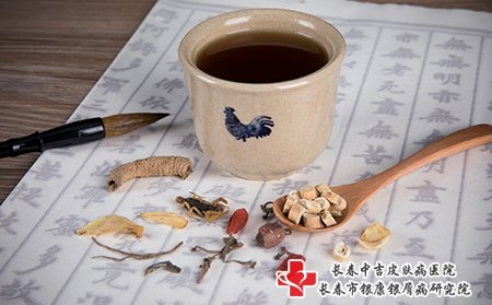 儿童牛皮癣建议中药治疗，安全，副作用小