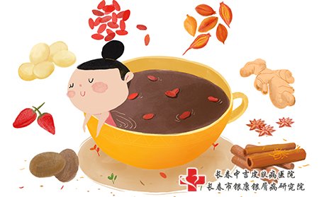 牛皮癣可以用中药泡浴，效果还不错