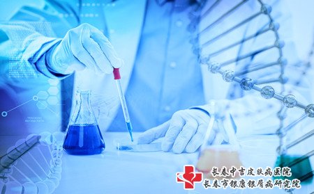 女性牛皮癣治疗,女性牛皮癣好治吗