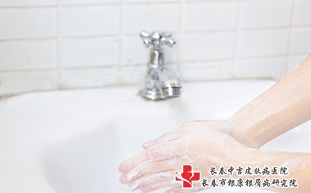 牛皮癣患者还要养成良好习惯