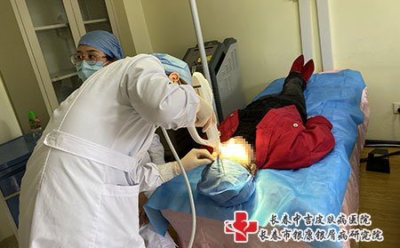 长春市牛皮癣专业医院：牛皮癣会造成哪些危害?