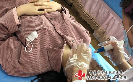 长春市中吉治疗牛皮癣的这几种不常见图片症状，您知道吗