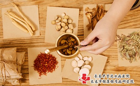 中药可以治疗牛皮癣