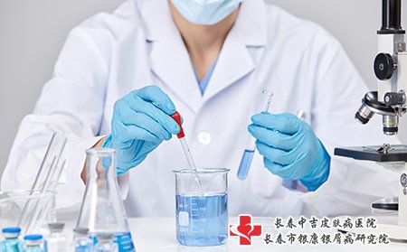 正规医院才能治好牛皮癣