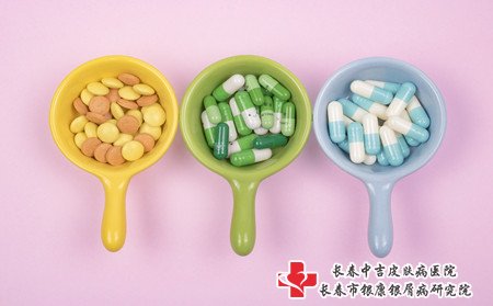 牛皮癣治疗,牛皮癣好不好治