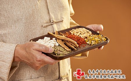 牛皮癣患者可以用中药内调