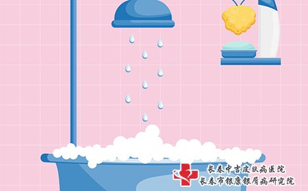牛皮癣患者的洗澡次数要注意