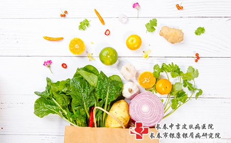 牛皮癣患者要注意饮食禁忌