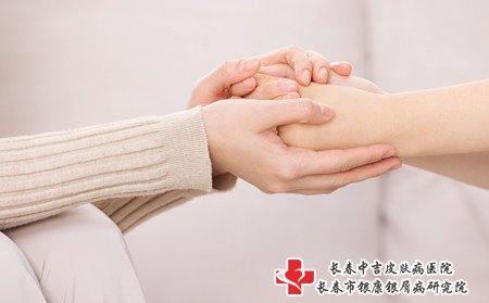 女性牛皮癣治疗,怎样治女性牛皮癣