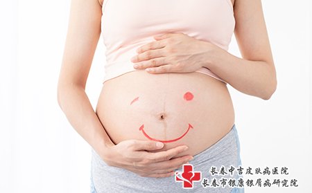 牛皮癣患者是可以生孩子的