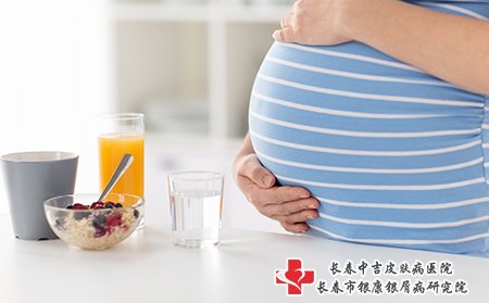 牛皮癣患者可以怀孕