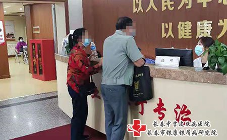 通化哪个医院牛皮癣治疗的最好