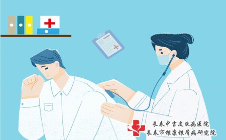 寻常型牛皮癣治疗,怎样治寻常型牛皮癣