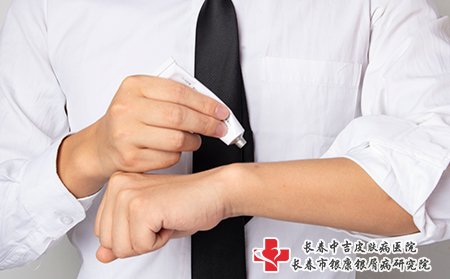 牛皮癣用药要注意安全