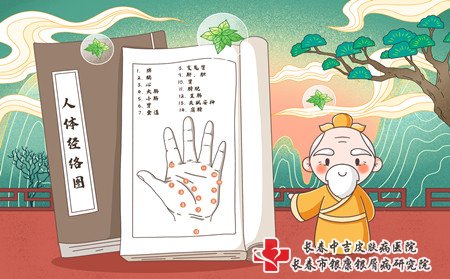 红皮型牛皮癣,红皮型牛皮癣要住院吗