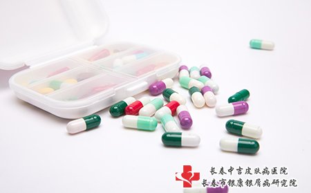 牛皮癣要及时治疗