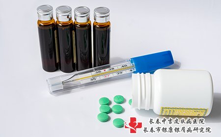牛皮癣用药要注意
