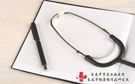 白山哪里治牛皮癣,去白山哪里治牛皮癣