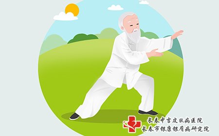 牛皮癣患者可以适当运动