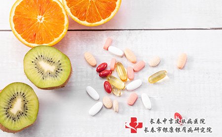 牛皮癣患者可以吃猕猴桃