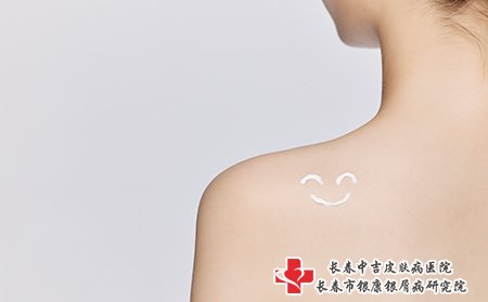 冬季要注意保湿