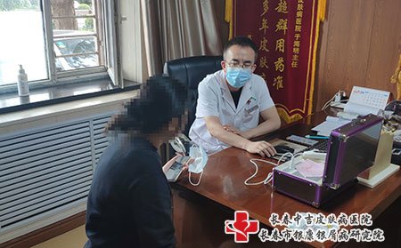 松原牛皮癣医院,松原去哪看牛皮癣比较好