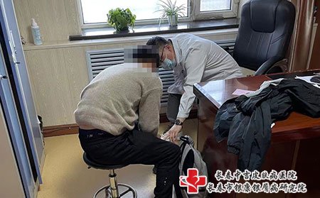 松原牛皮癣医院,松原去哪看的牛皮癣好