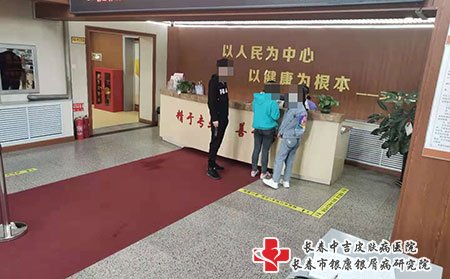 松原牛皮癣医院,松原什么医院治疗牛皮癣好