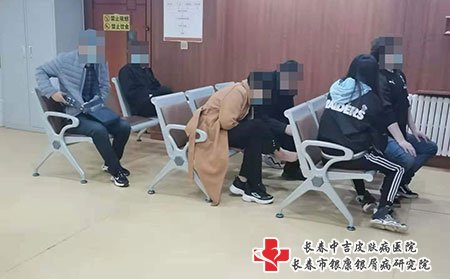 松原牛皮癣医院,松原如何治牛皮癣