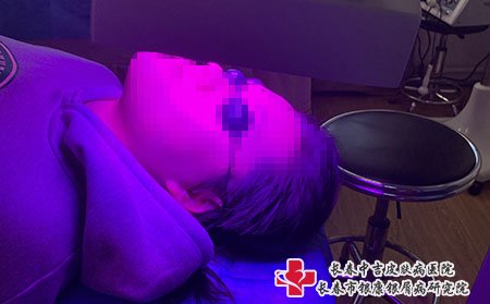 长春牛皮癣医院,长春哪家医院可以治疗牛皮癣