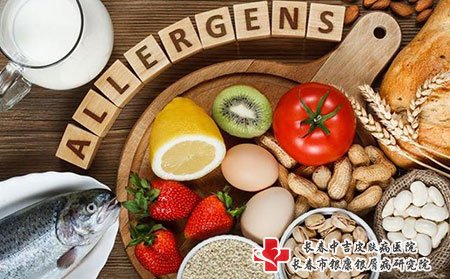 长春中吉牛皮癣医院：患有牛皮癣的人不能吃这七种食物
