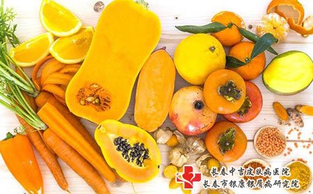 长春中吉牛皮癣医院地址
