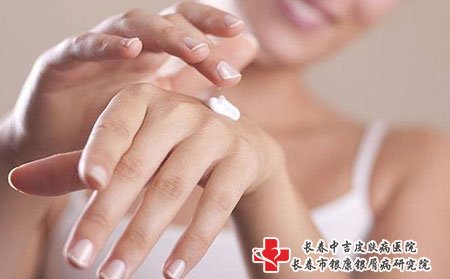 手背上有牛皮癣要怎样治疗?