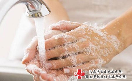 预防牛皮癣复发