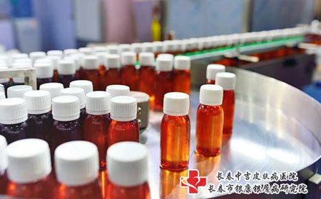 长春中吉牛皮癣医院花费高吗?