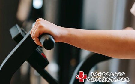 牛皮癣需要注意什么，怎样防护?
