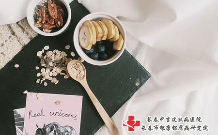 得了牛皮癣要注意吃什么?