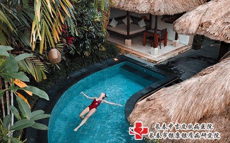 头皮上的牛皮癣瘙痒怎么办，能抓痒吗