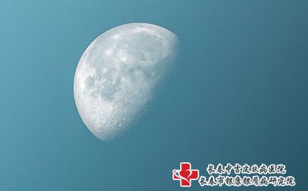 辽源牛皮癣治疗-脖子上牛皮癣咋护理