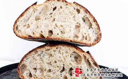 治疗牛皮癣的用药原则有哪些?长春中吉牛皮癣医院告诉您