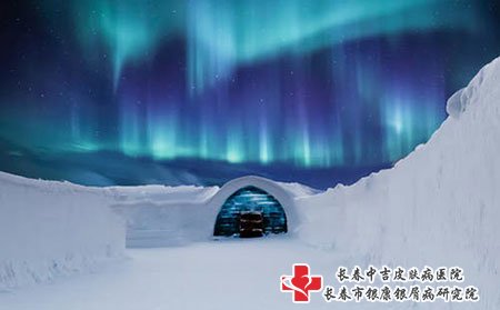 牛皮癣怎么治疗好