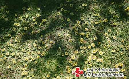 长春中吉牛皮癣医院挂号，手部牛皮癣的治疗