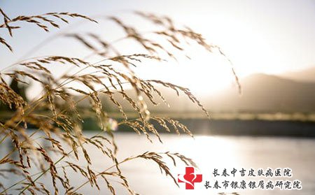 牛皮癣好的治疗方法