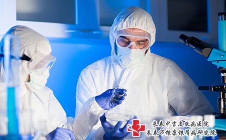 如何调理牛皮癣对治疗才有好处?