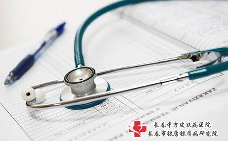 牛皮癣怎么治疗