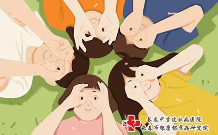 点滴型牛皮癣的症状表现有哪些
