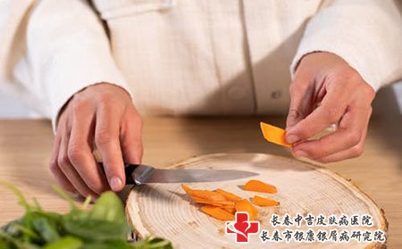 牛皮癣患者不能吃生鸡蛋吗?