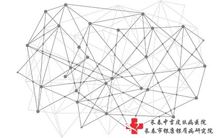 长春牛皮癣医院哪家好,长春中吉牛皮癣医院,长春哪里能治牛皮癣