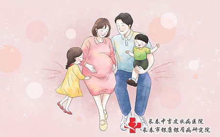 长春牛皮癣医院哪家好,长春中吉牛皮癣医院,长春治小孩牛皮癣哪家医院好